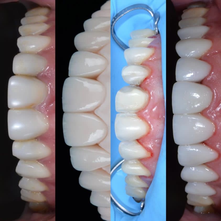 Juan Camilo Castillo-8