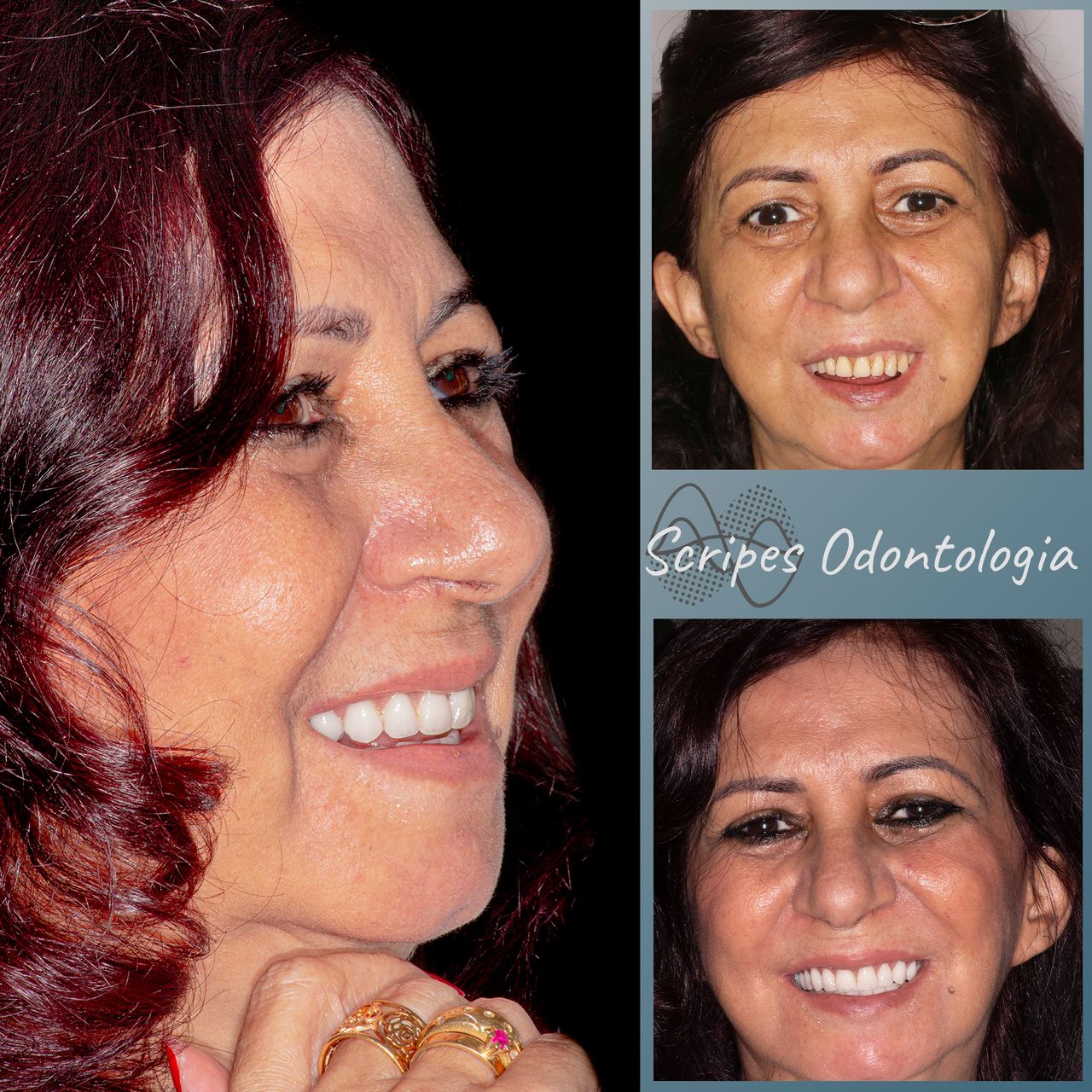 Gabriel Godoy Scripes-69