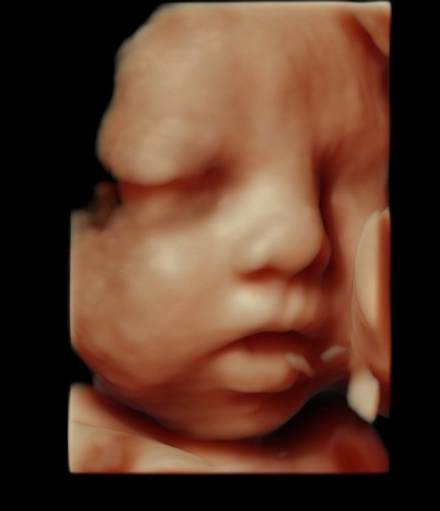 Charles Schwantz De Lima-34