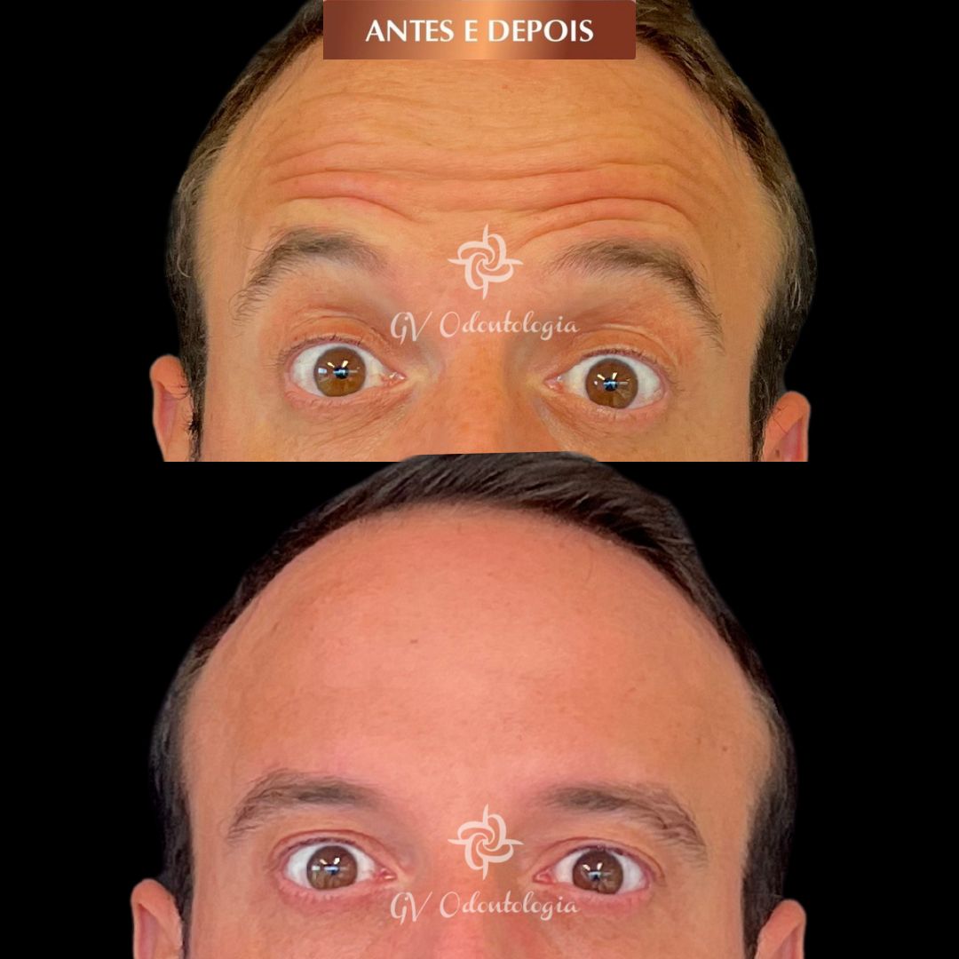 Gisele De Carvalho Versannio-48