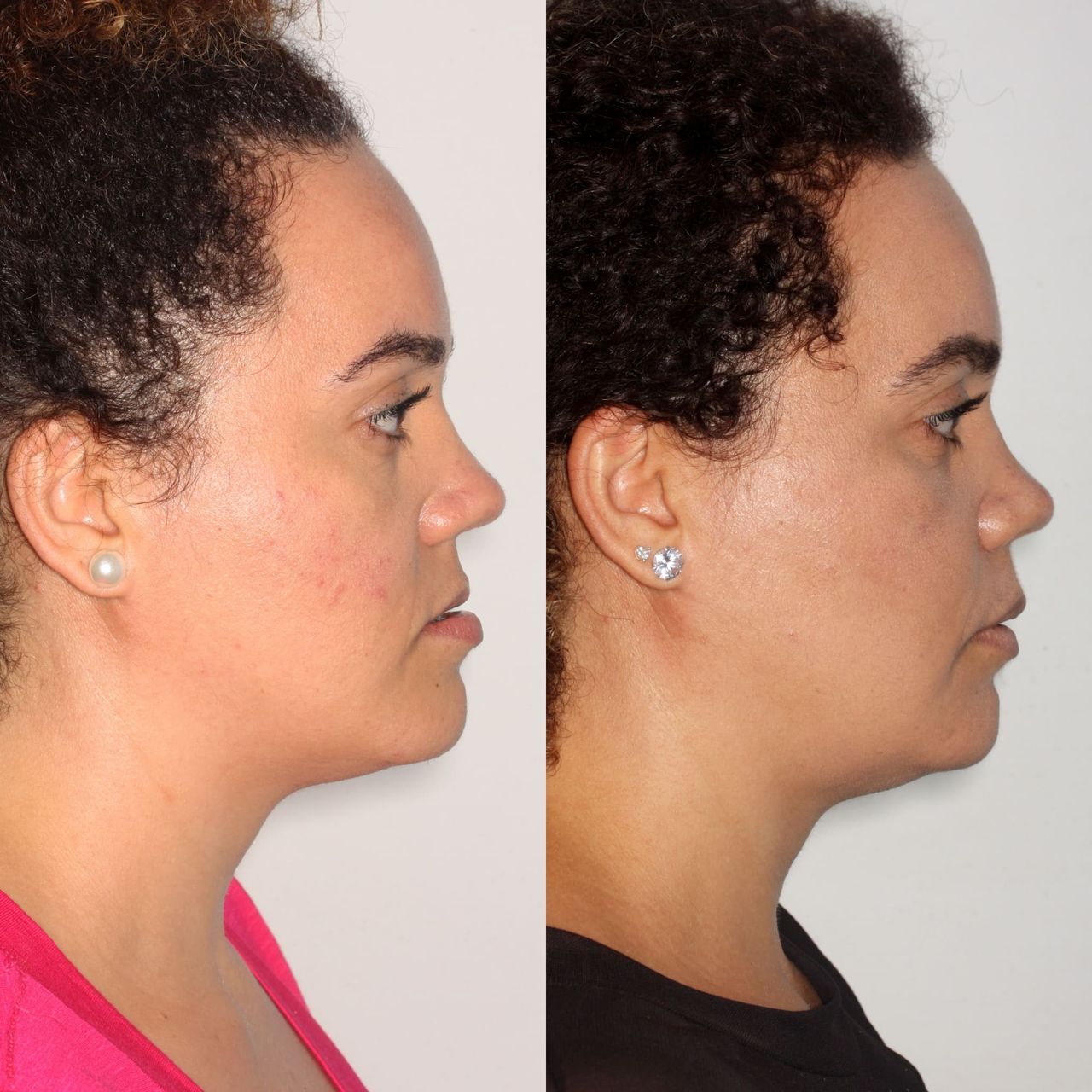 Raffael Maron Vieira De Noronha-28