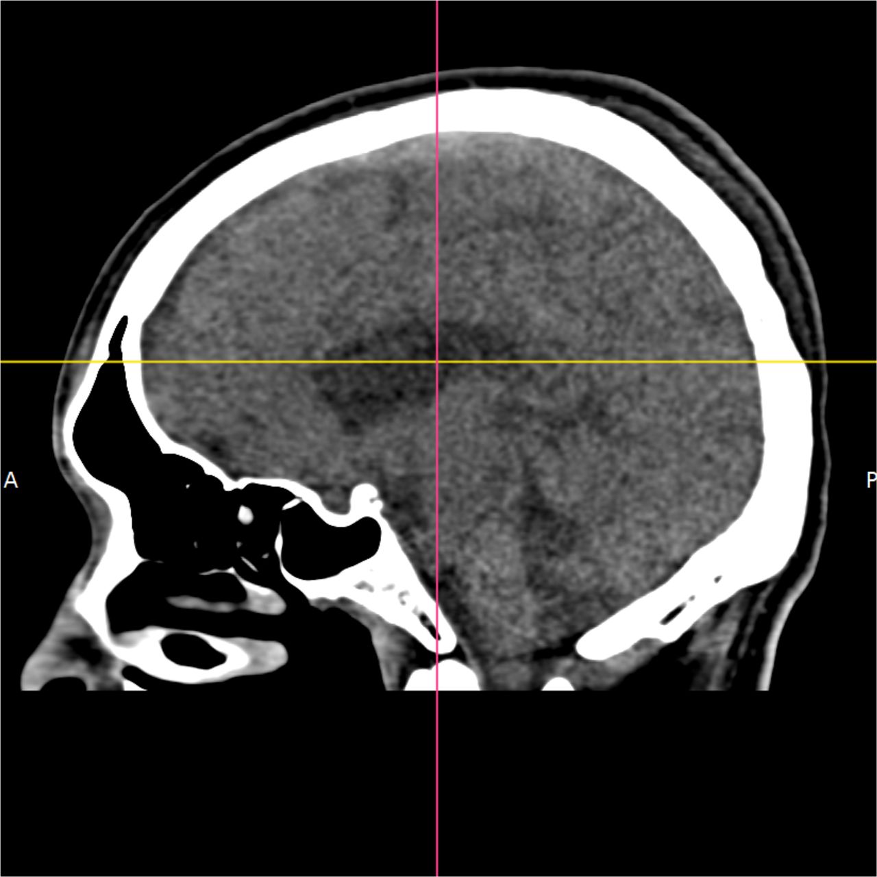 David Tafur Muñoz-2064