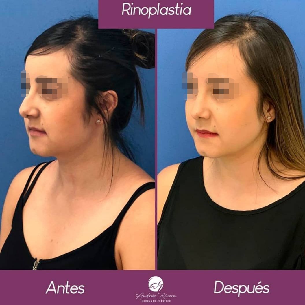 Andrés Rivera López-19