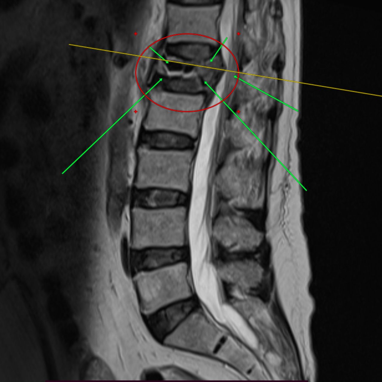 David Tafur Muñoz-1567