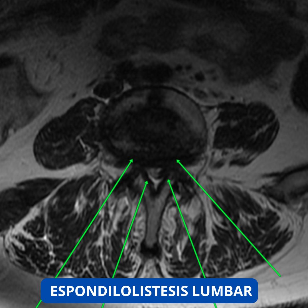 David Tafur Muñoz-2307