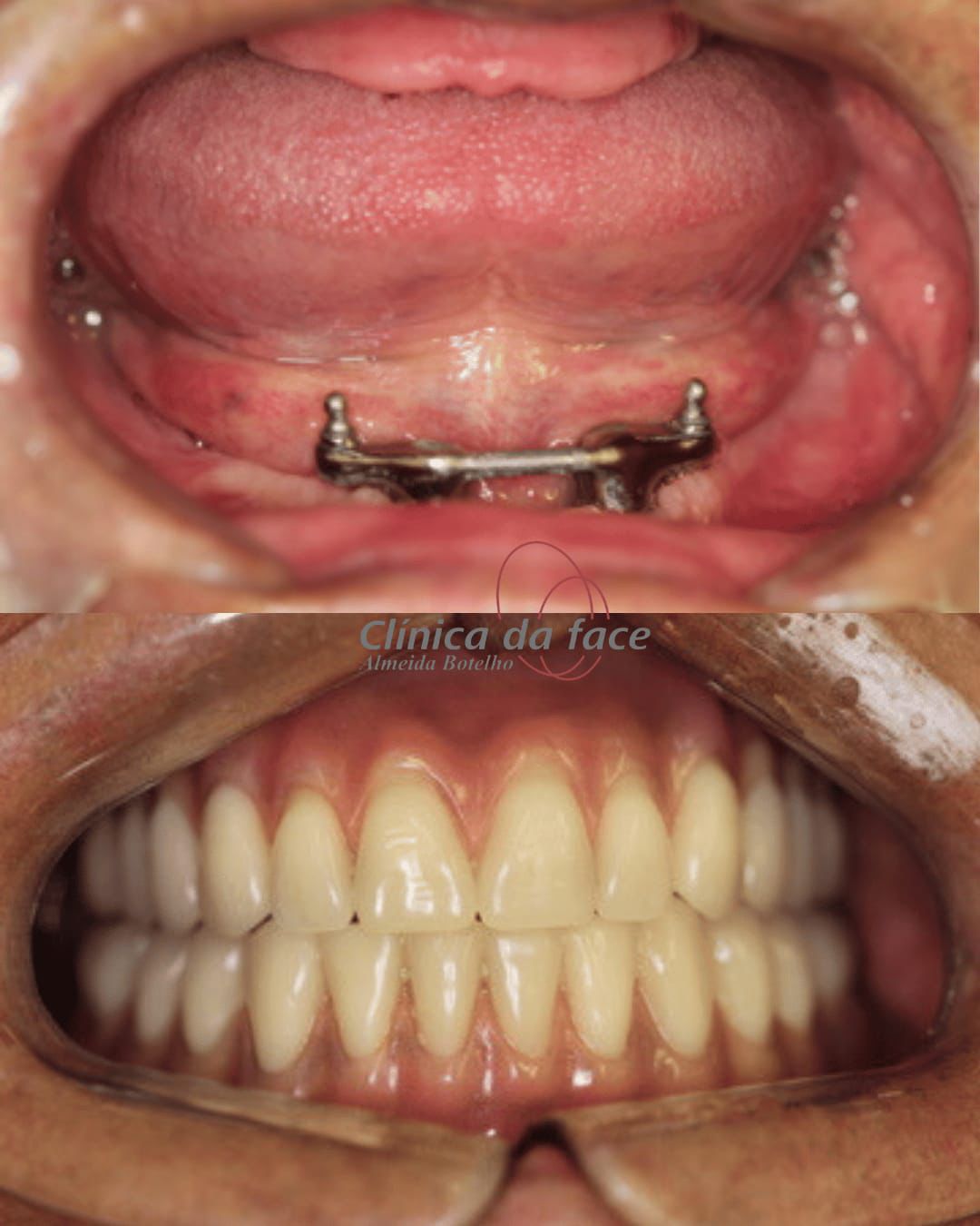 Odilia Liliam Almeida Botelho-1