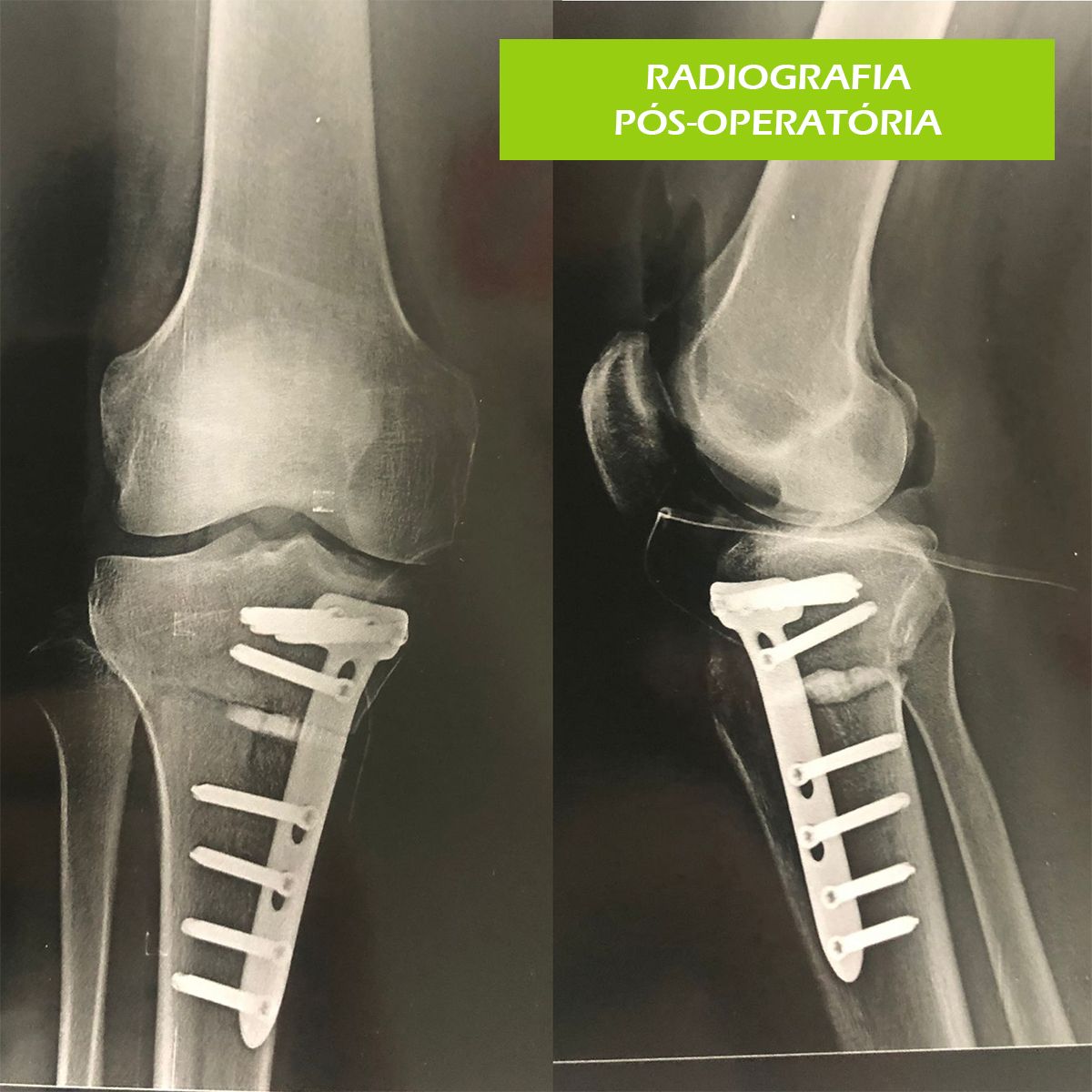 Paulo Roberto Capelletti-45