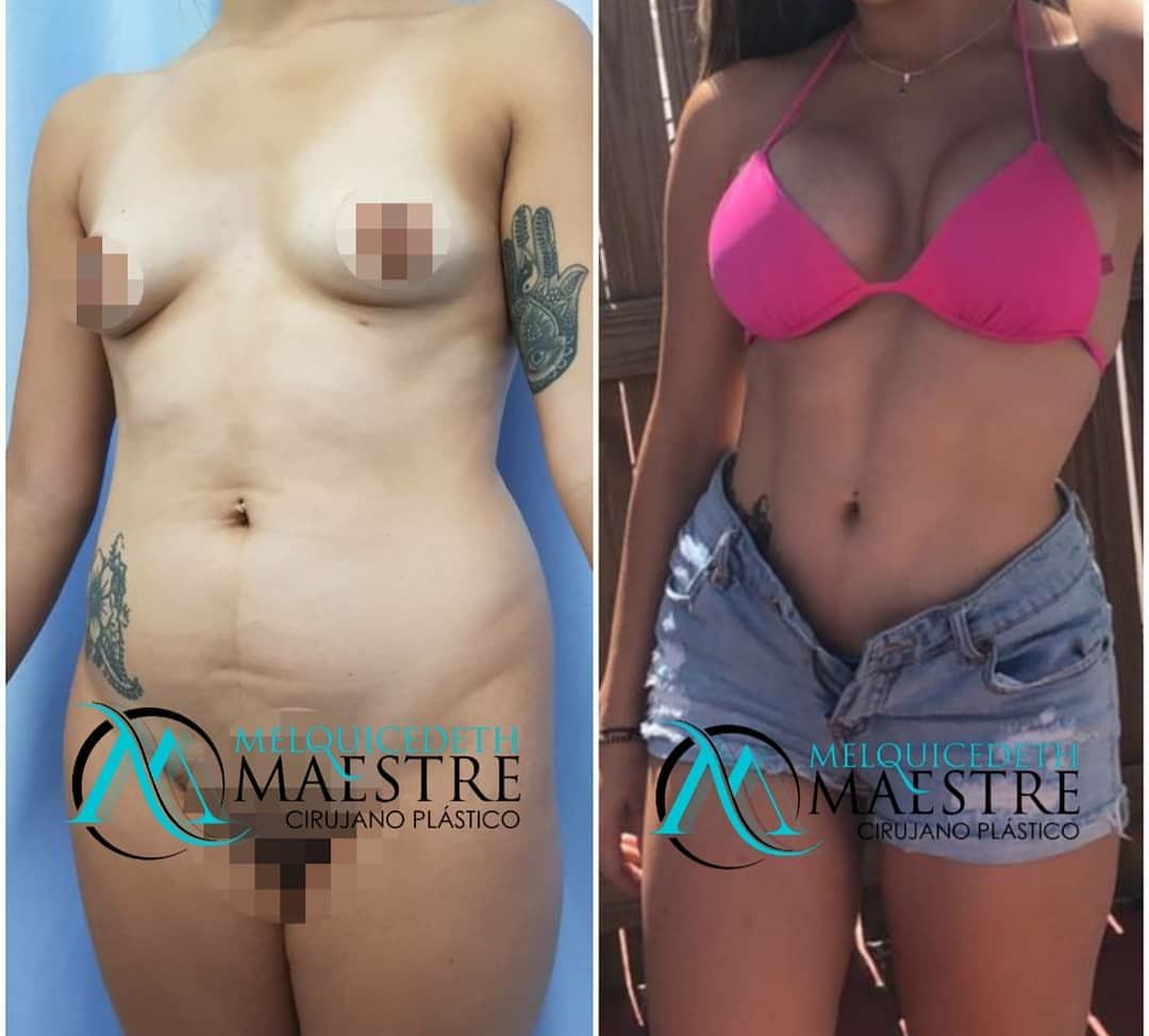 Melquicedeth Maestre-7