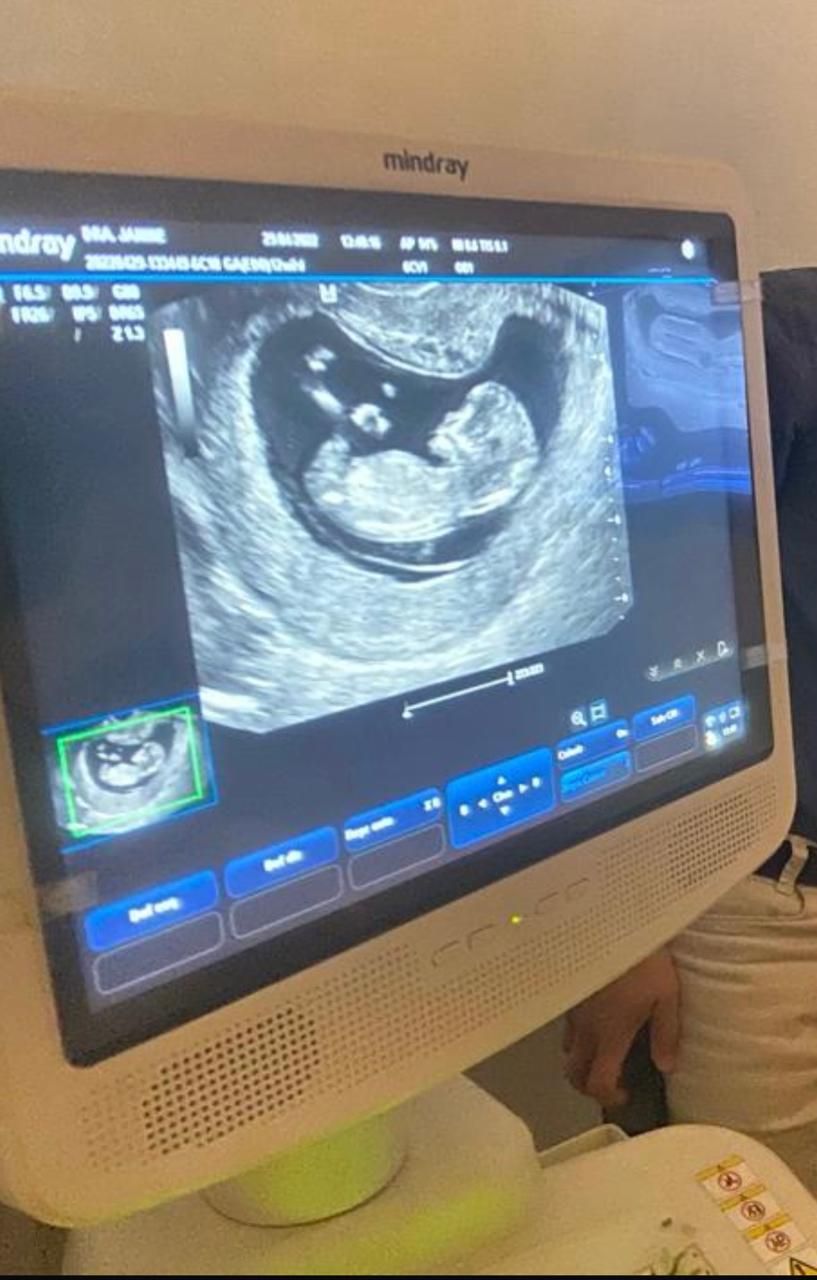 Jaqueline Rapoport-7