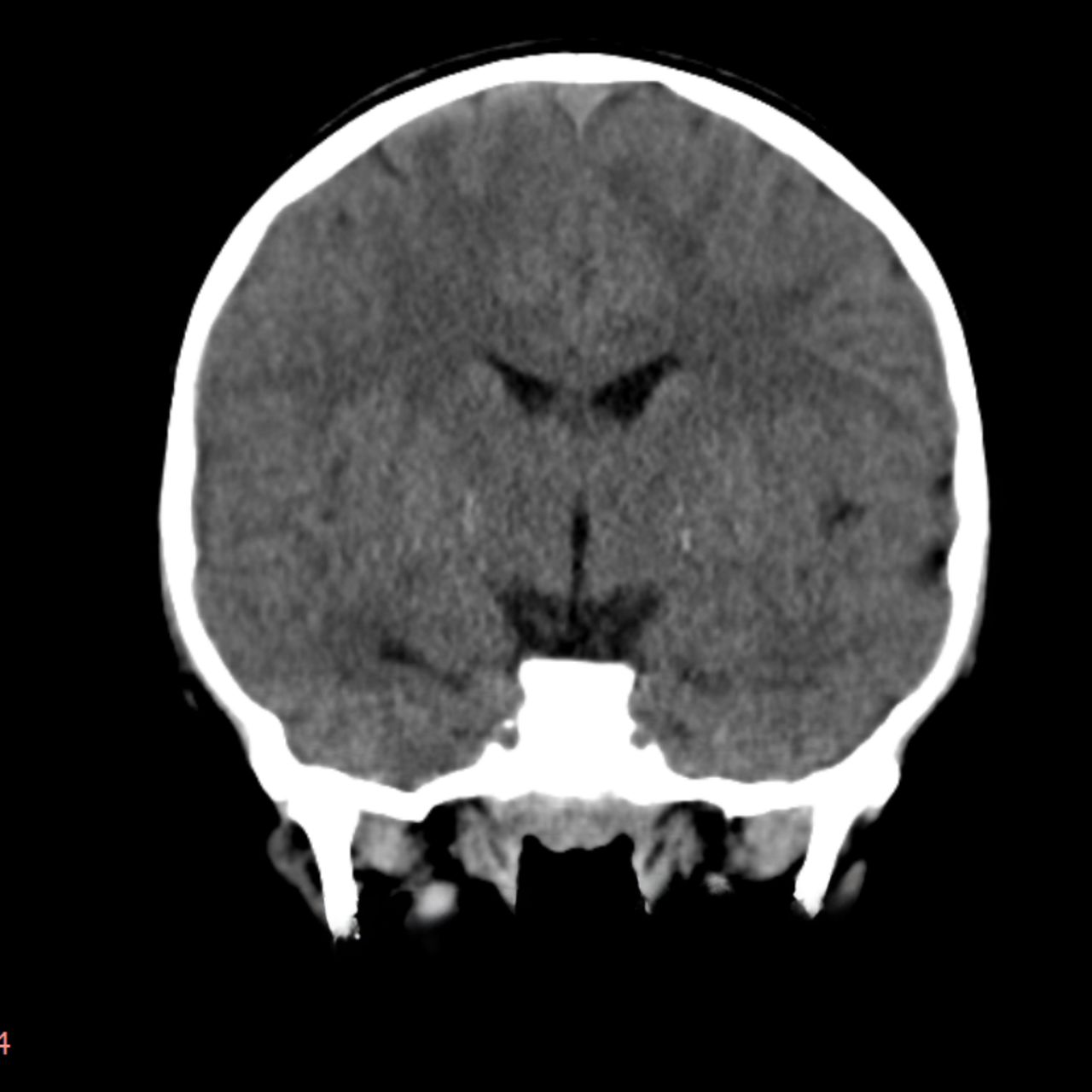 David Tafur Muñoz-1534