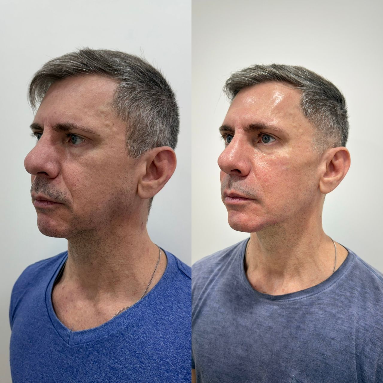 Caroline Benedeti-50