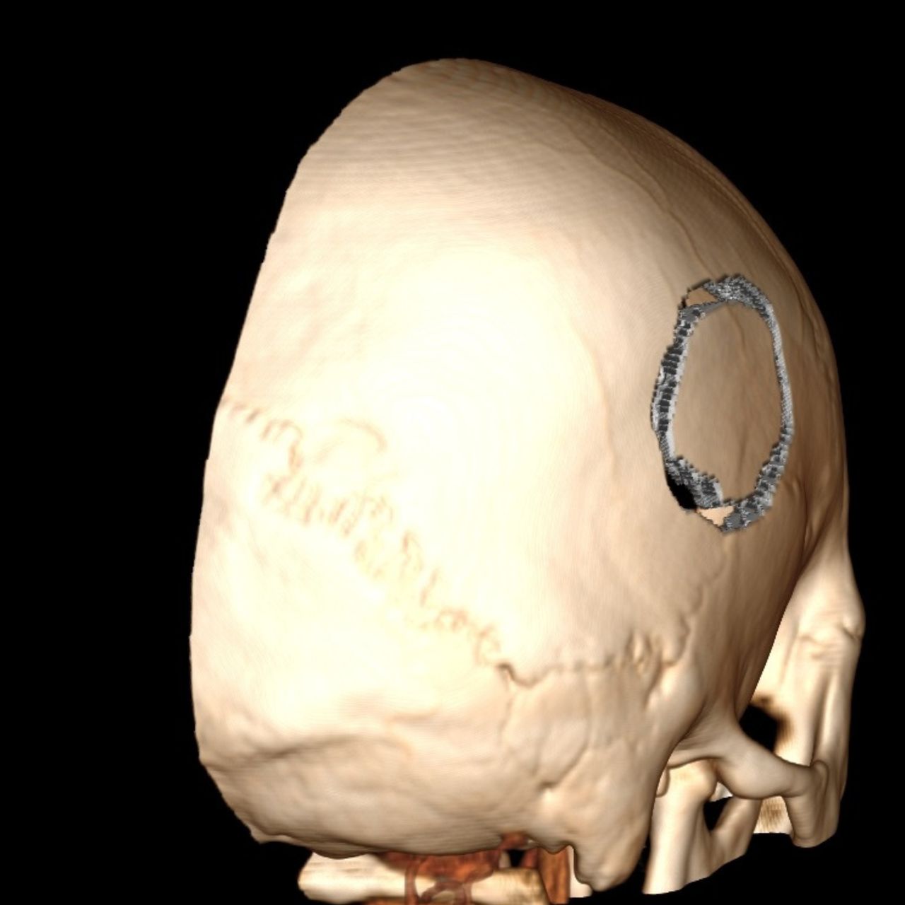 David Tafur Muñoz-1353