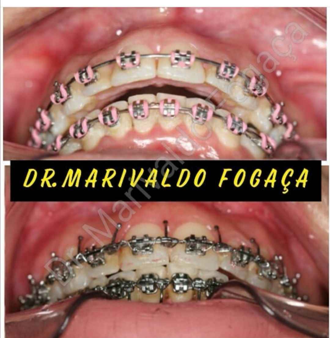 Marivaldo Fogaça-11