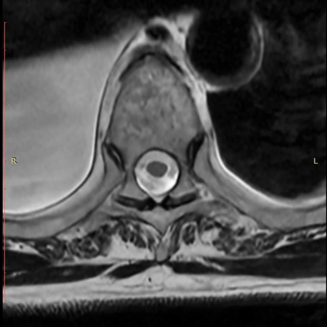 David Tafur Muñoz-1778