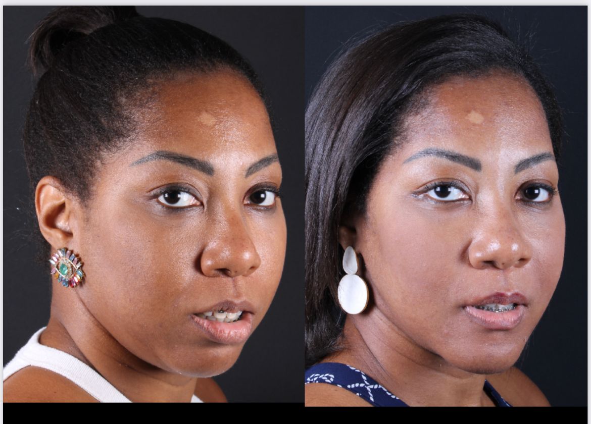 Frederico Carnevale-6