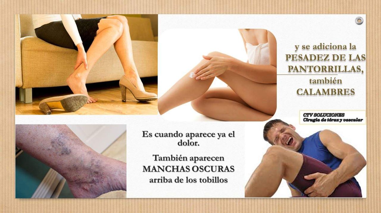 Walter Rodolfo Calle Mendoza-5