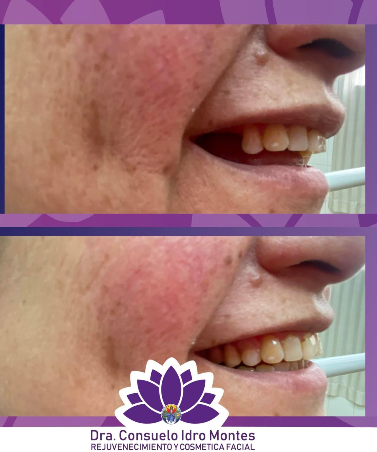 María Consuelo Idro Montes-4