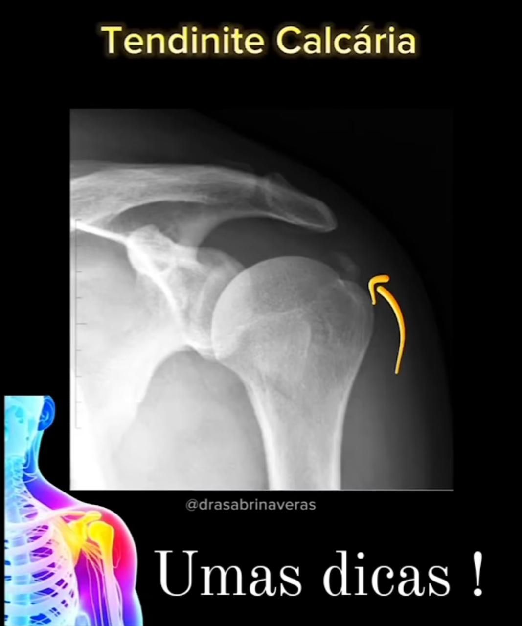 Orlando Turpo Mamani-2