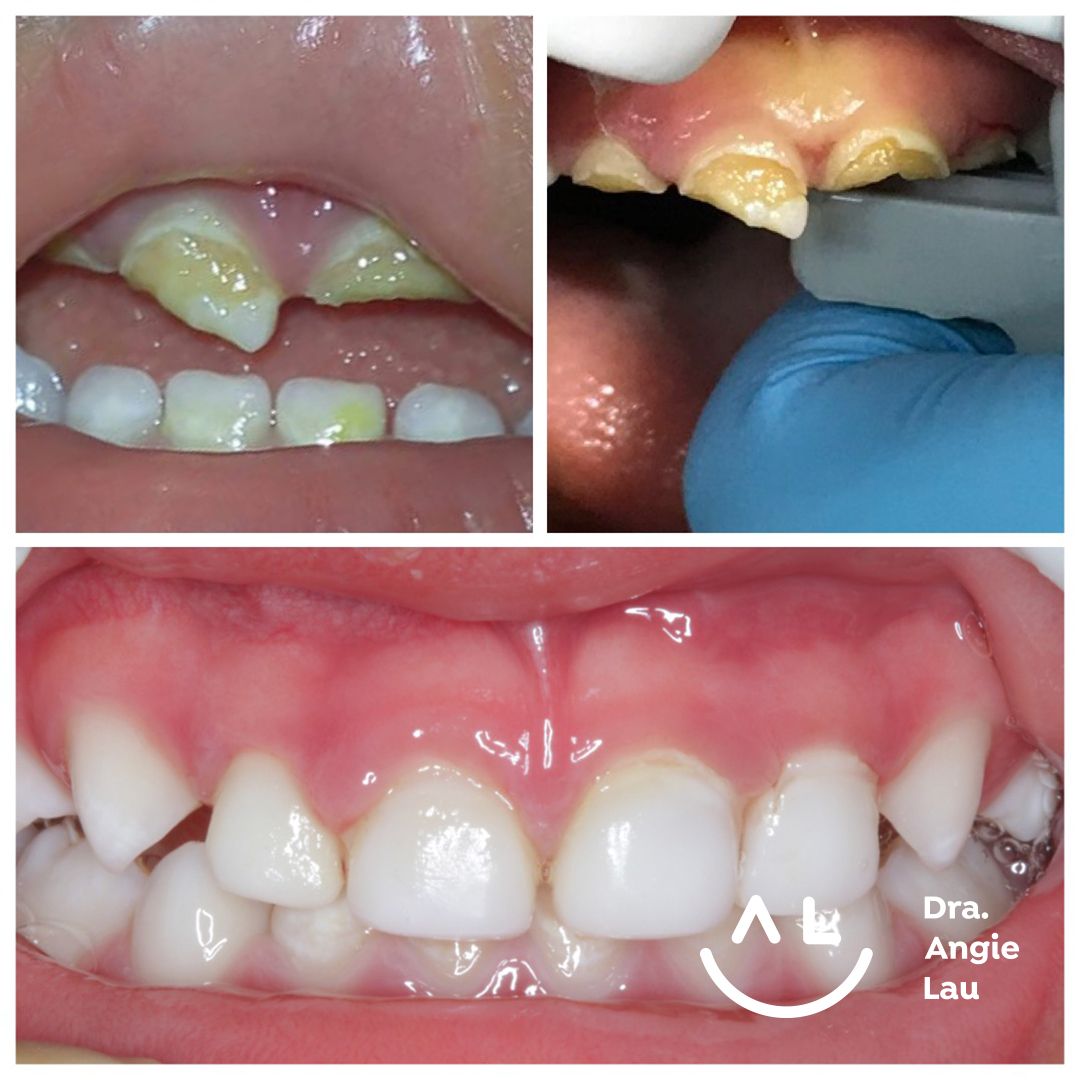 Angie Lau Muñante-5