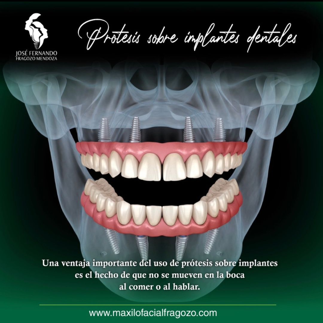 Jose Fernando Fragozo Mendoza-8