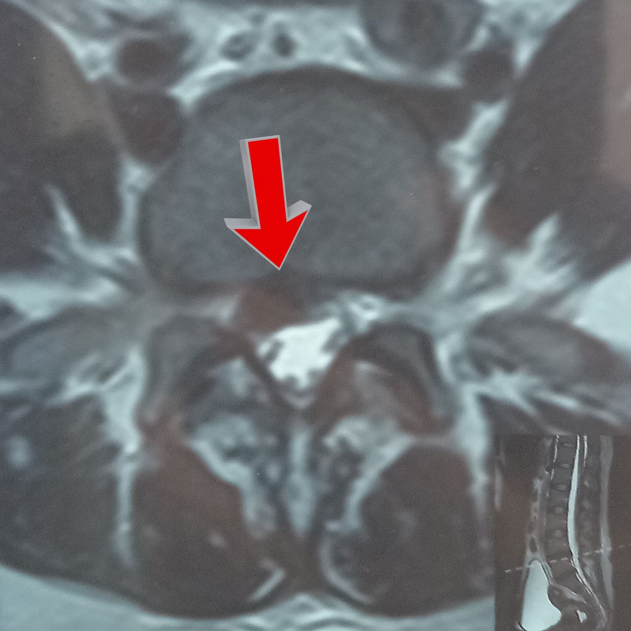 David Tafur Muñoz-1403