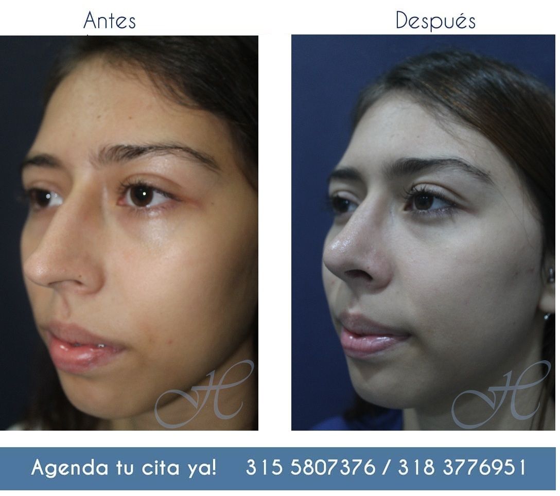 Jorge A Holguin Ruiz-40