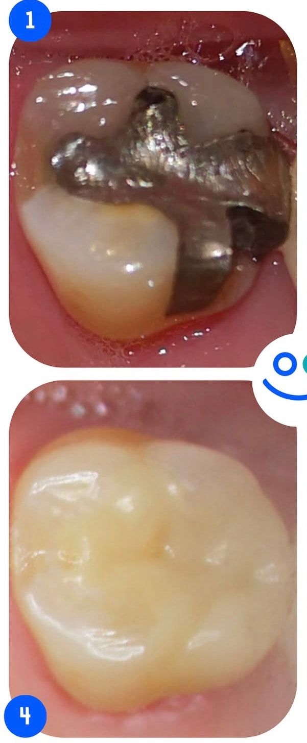 Oscar Campos Beltrán-6