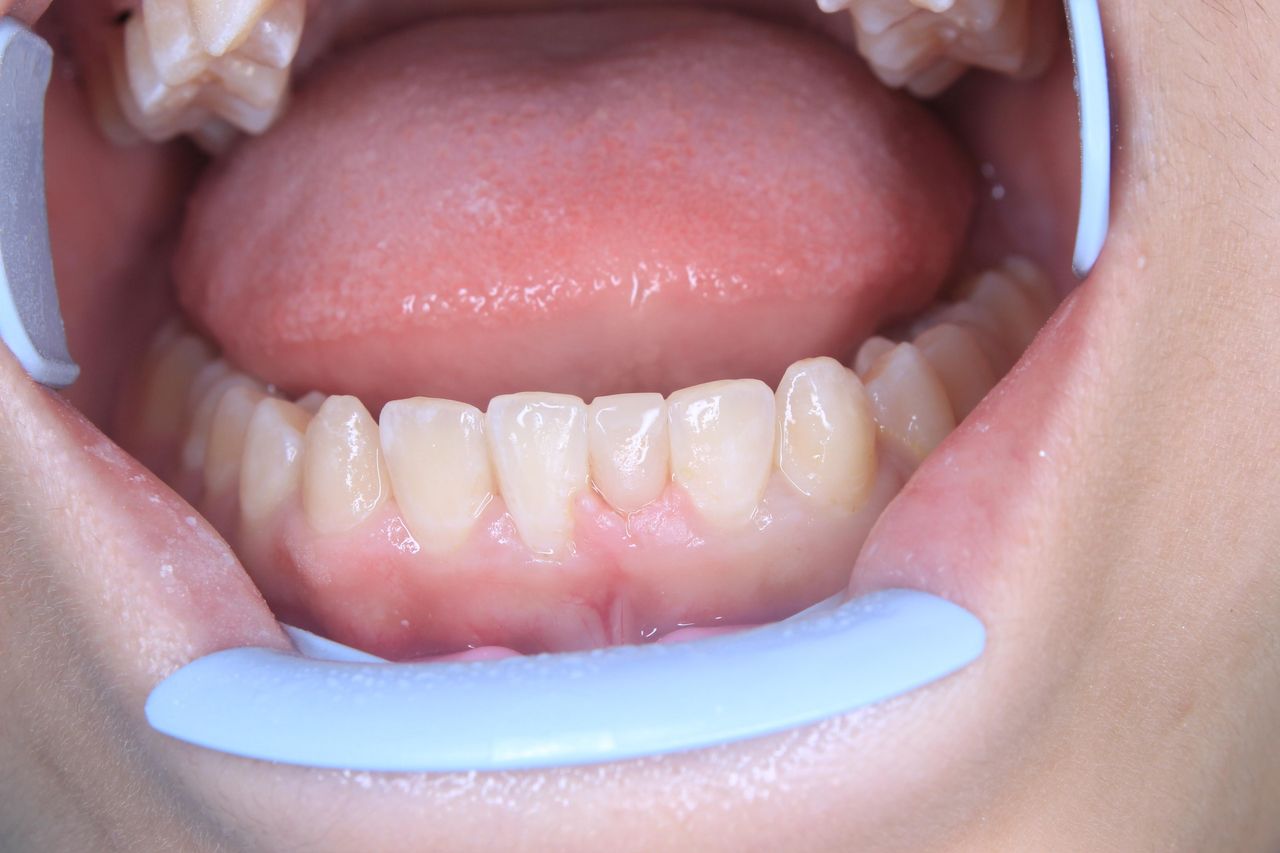 Francisco Bahamonde-10