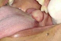 Alexandre Giannini-12