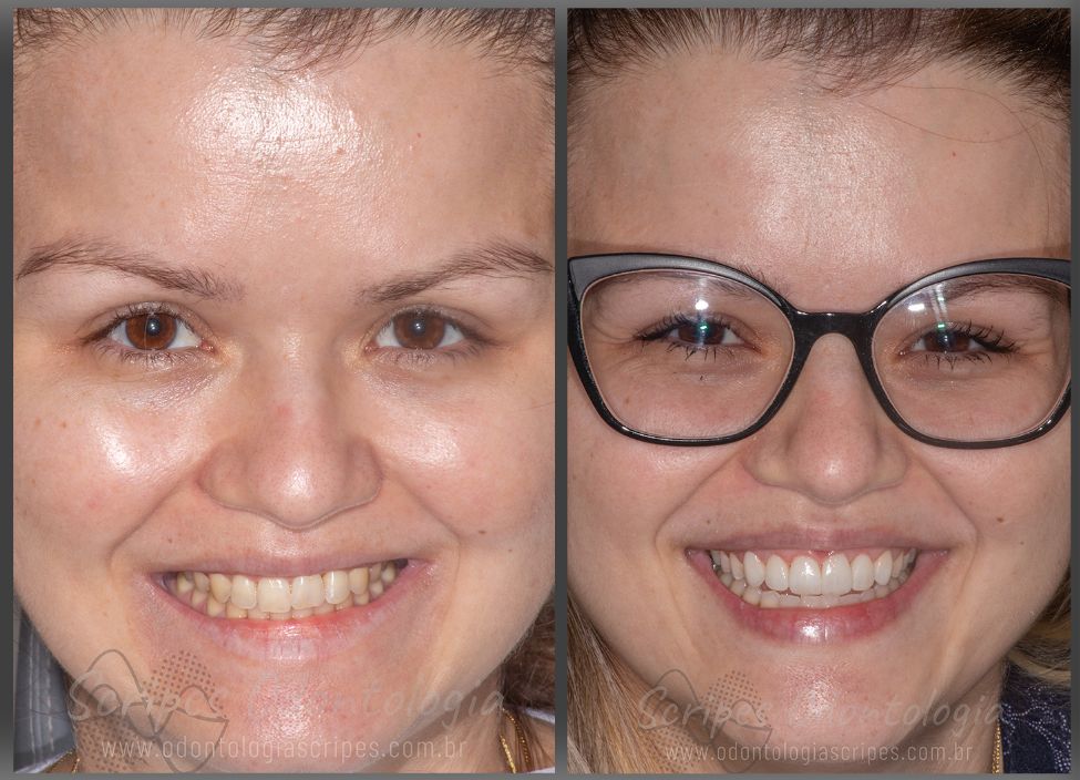 Gabriel Godoy Scripes-72