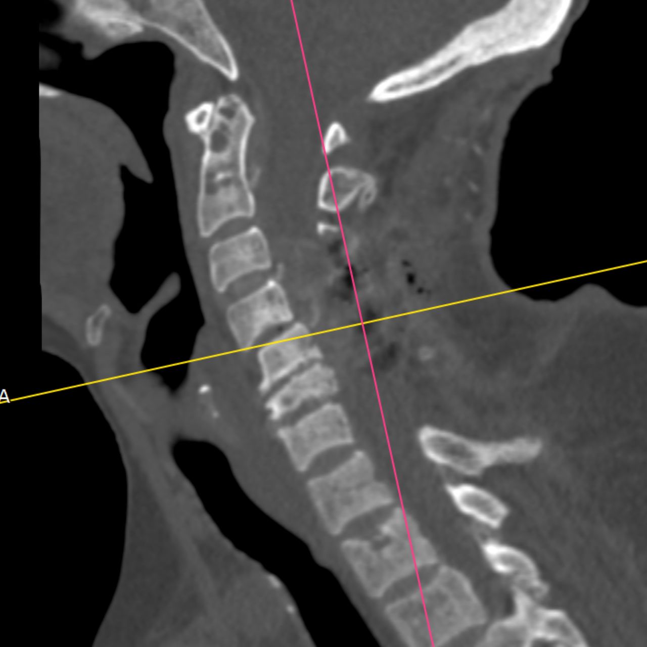 David Tafur Muñoz-1964