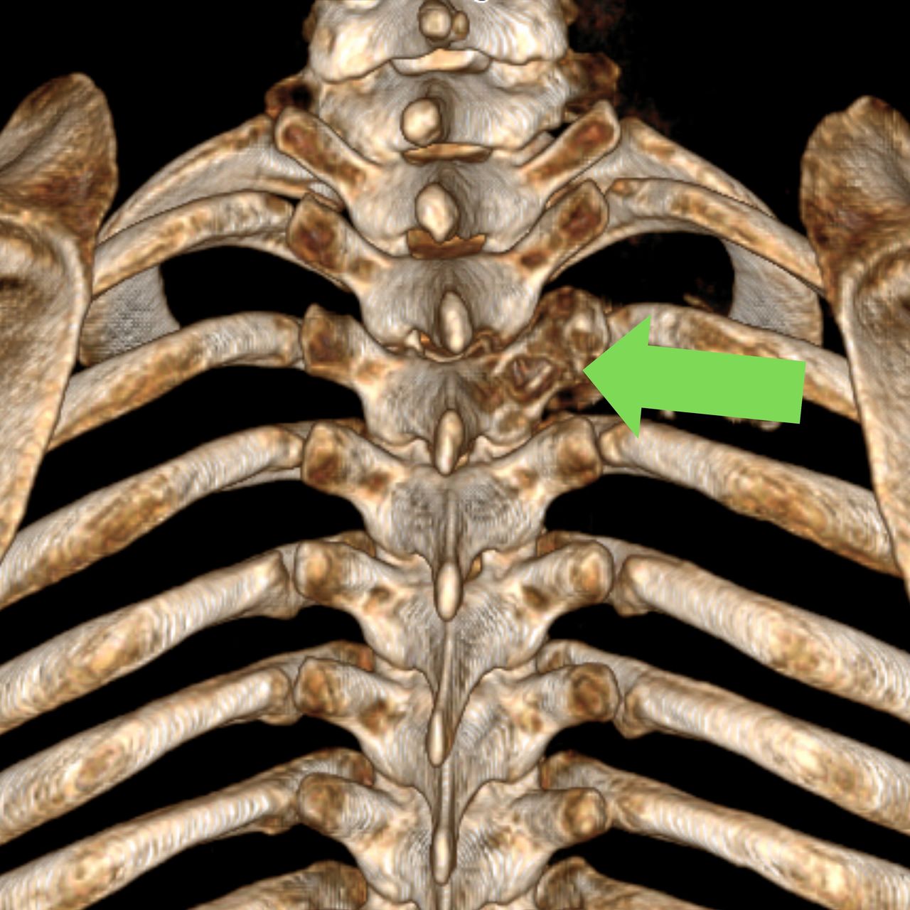 David Tafur Muñoz-2489