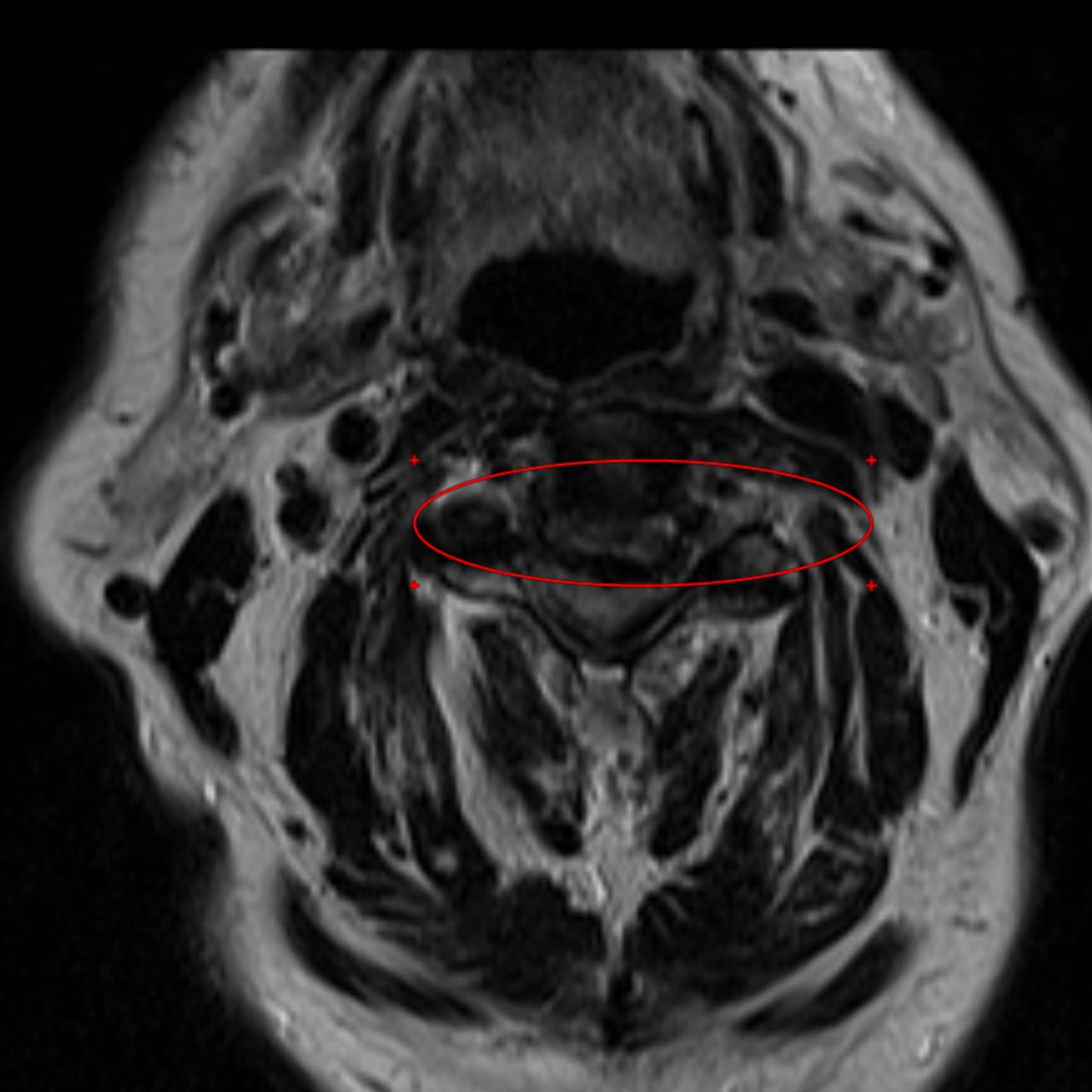 David Tafur Muñoz-1540