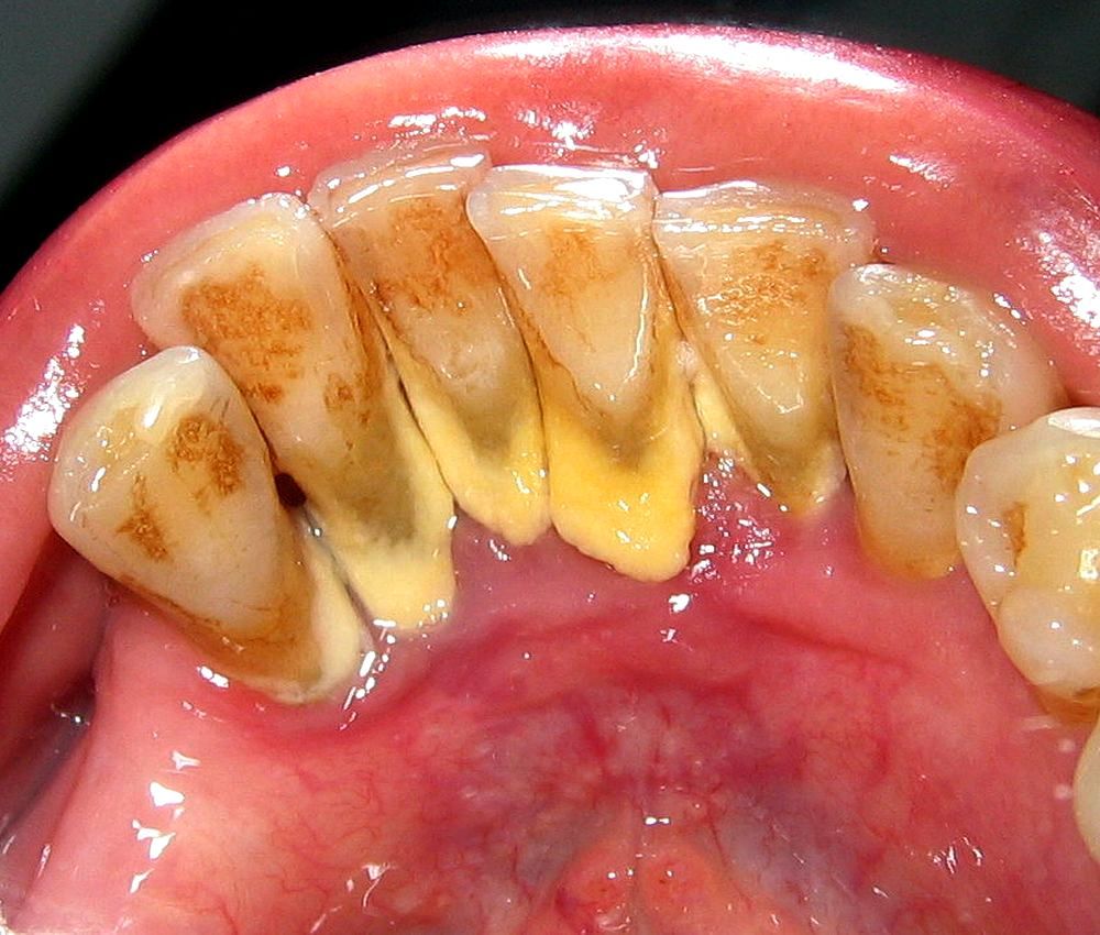 Ignacio Pezo Mundaca-5