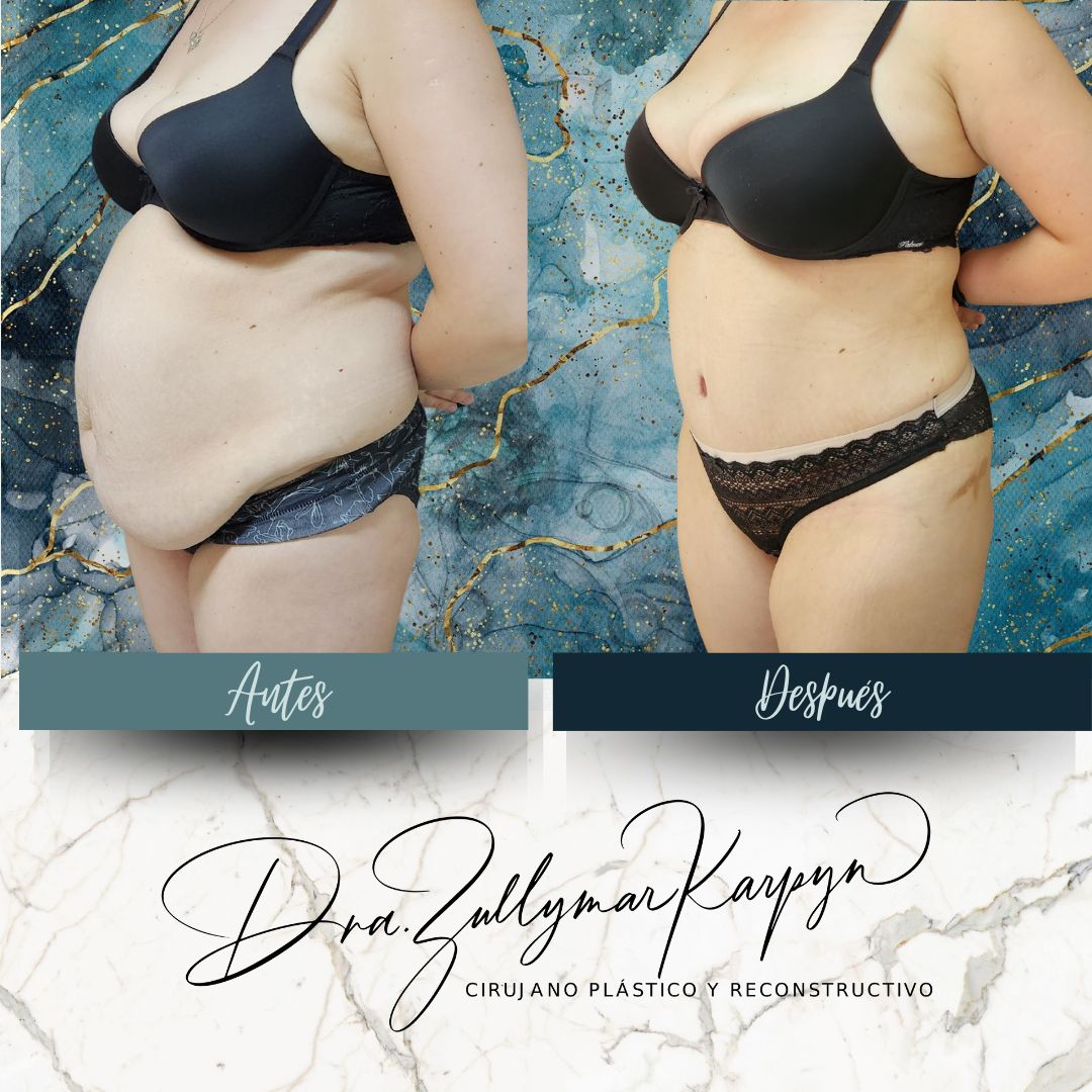 Zullymar Karpyn Brito-5