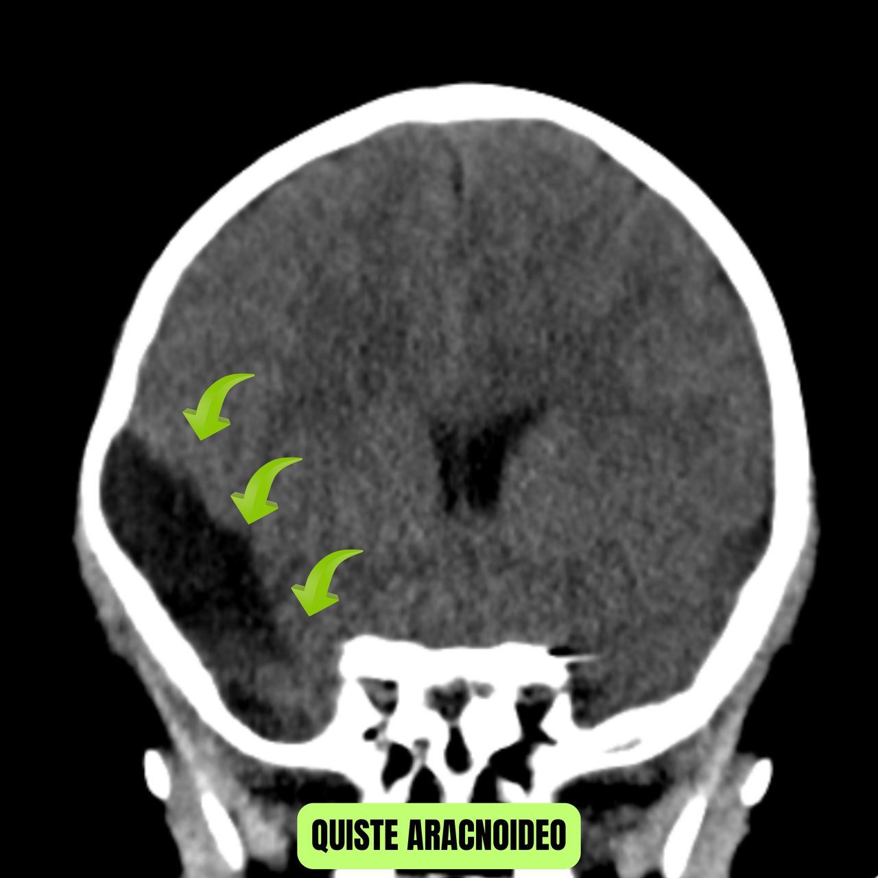 David Tafur Muñoz-1991