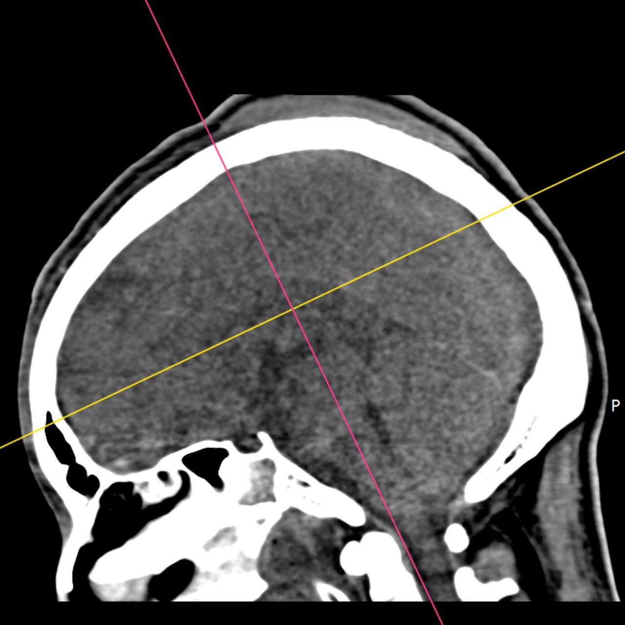 David Tafur Muñoz-1702
