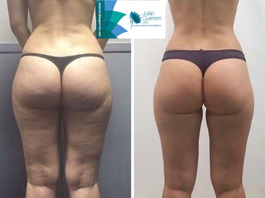 Julián Guerrero Almeida-40