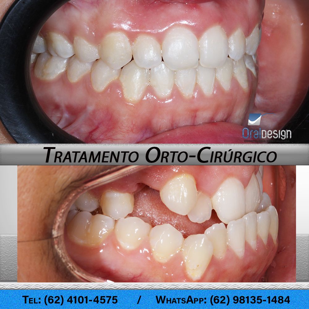 Danilo Monteiro Rezende Pereira-5