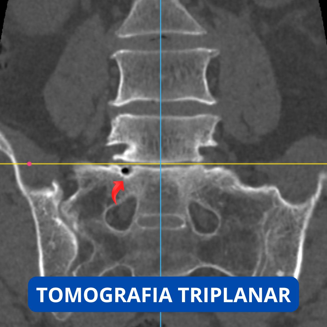 David Tafur Muñoz-2321