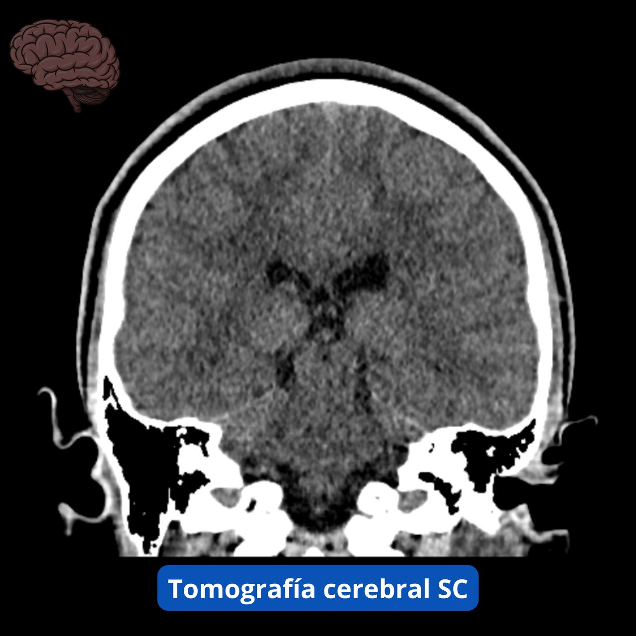 David Tafur Muñoz-1136