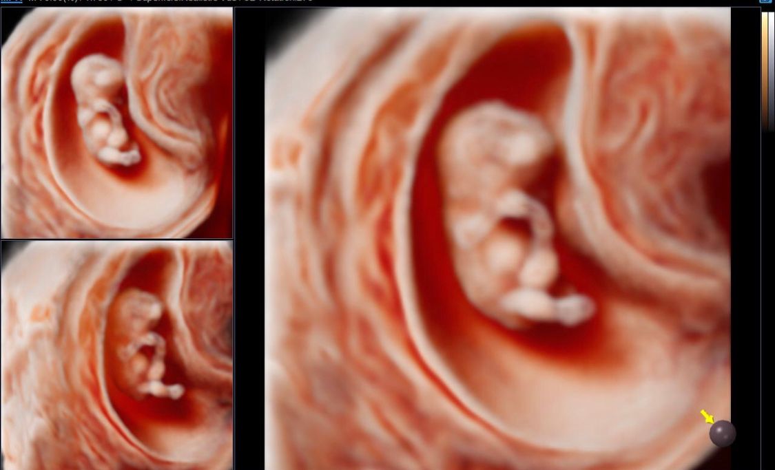 Jonh Harold Alvis Botello-14