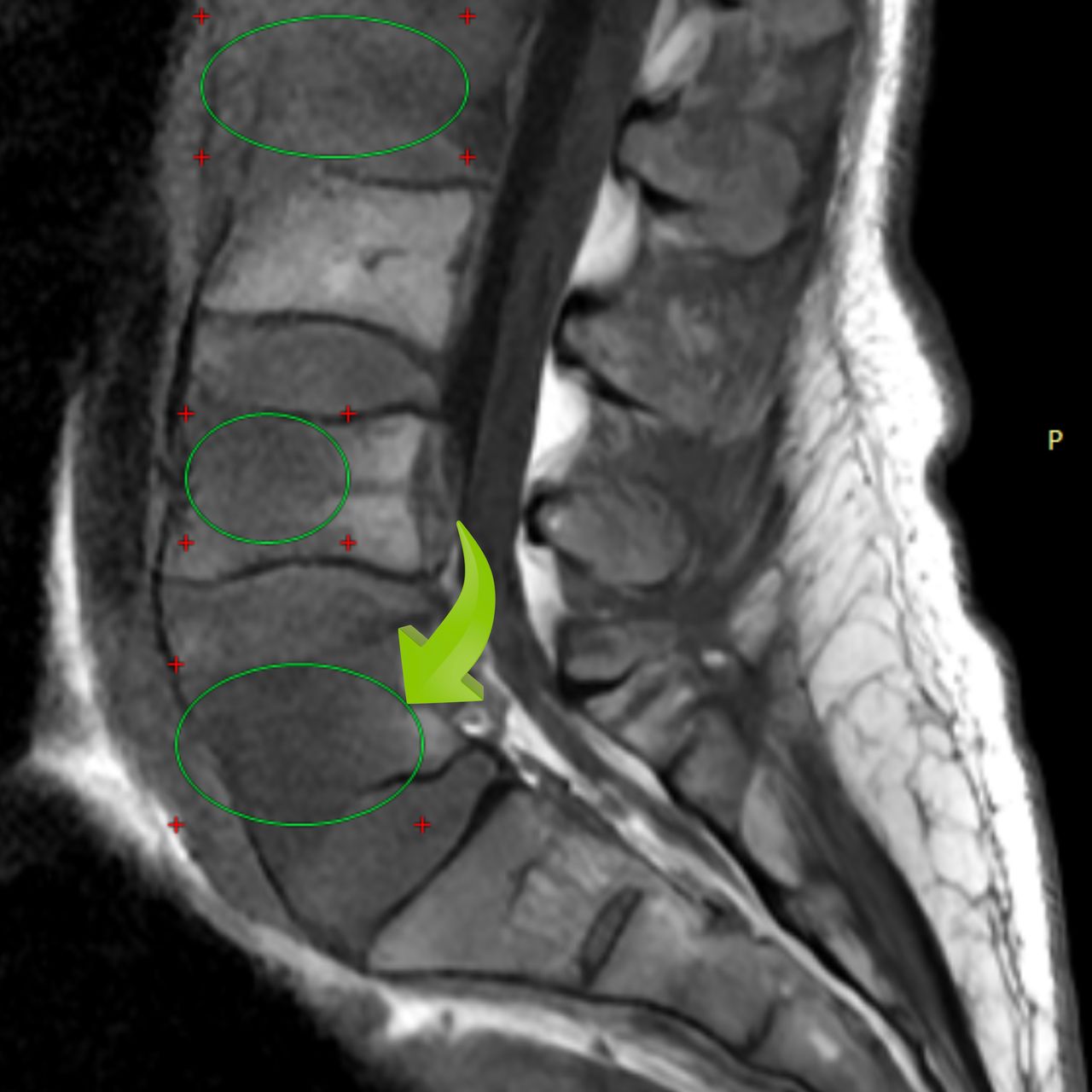 David Tafur Muñoz-1480