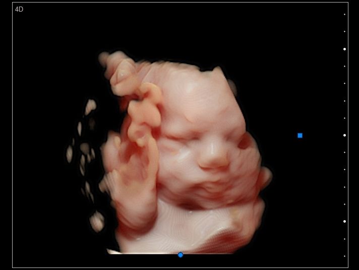 Lady Tatiana Duarte Lopez-11