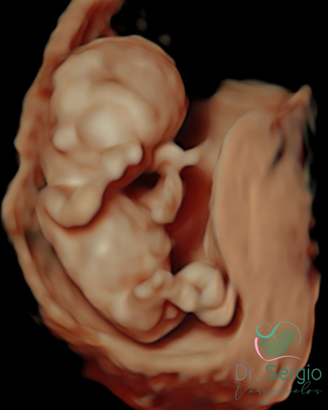 Sérgio De Abreu Vasconcelos Neto-3