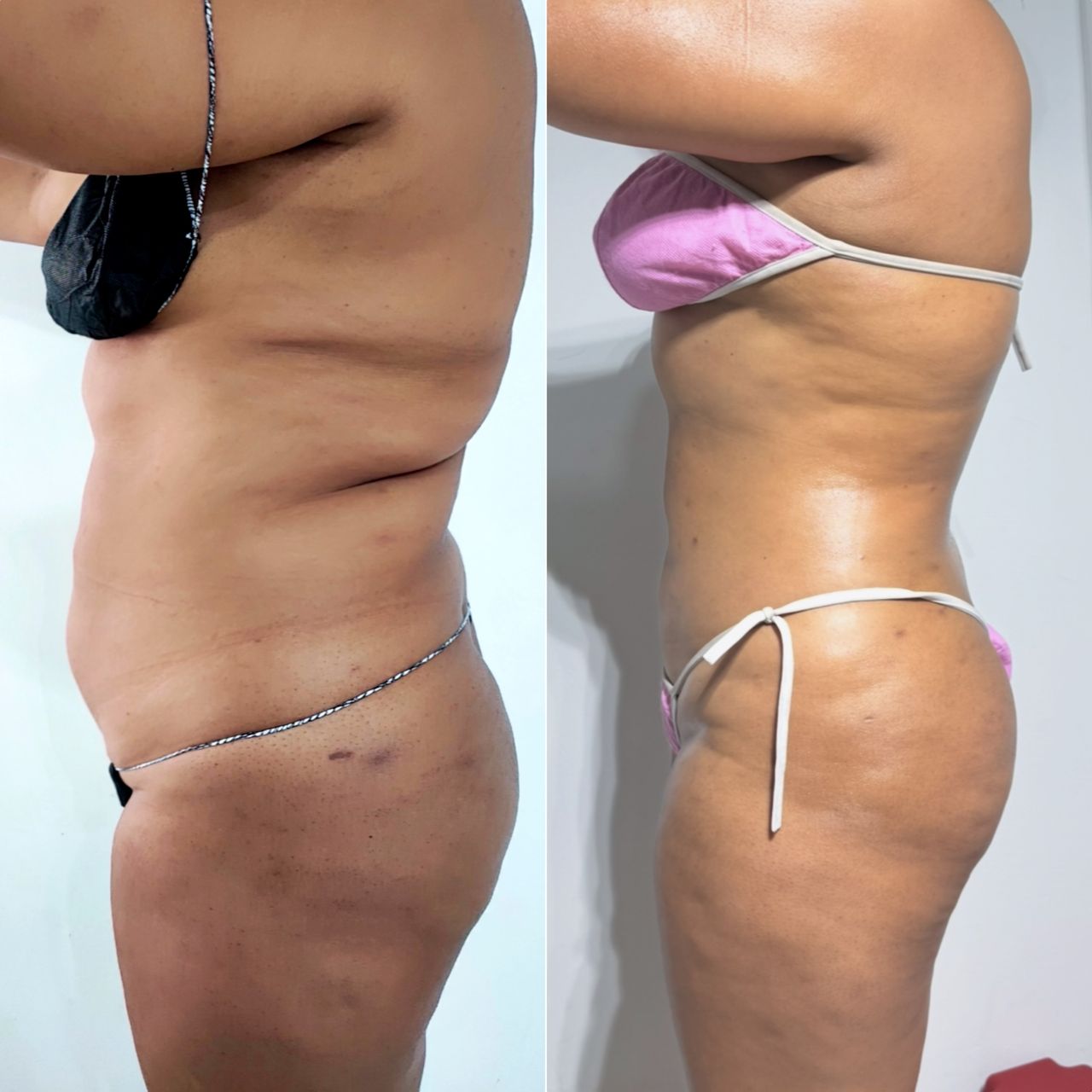 Linda Muñoz-31