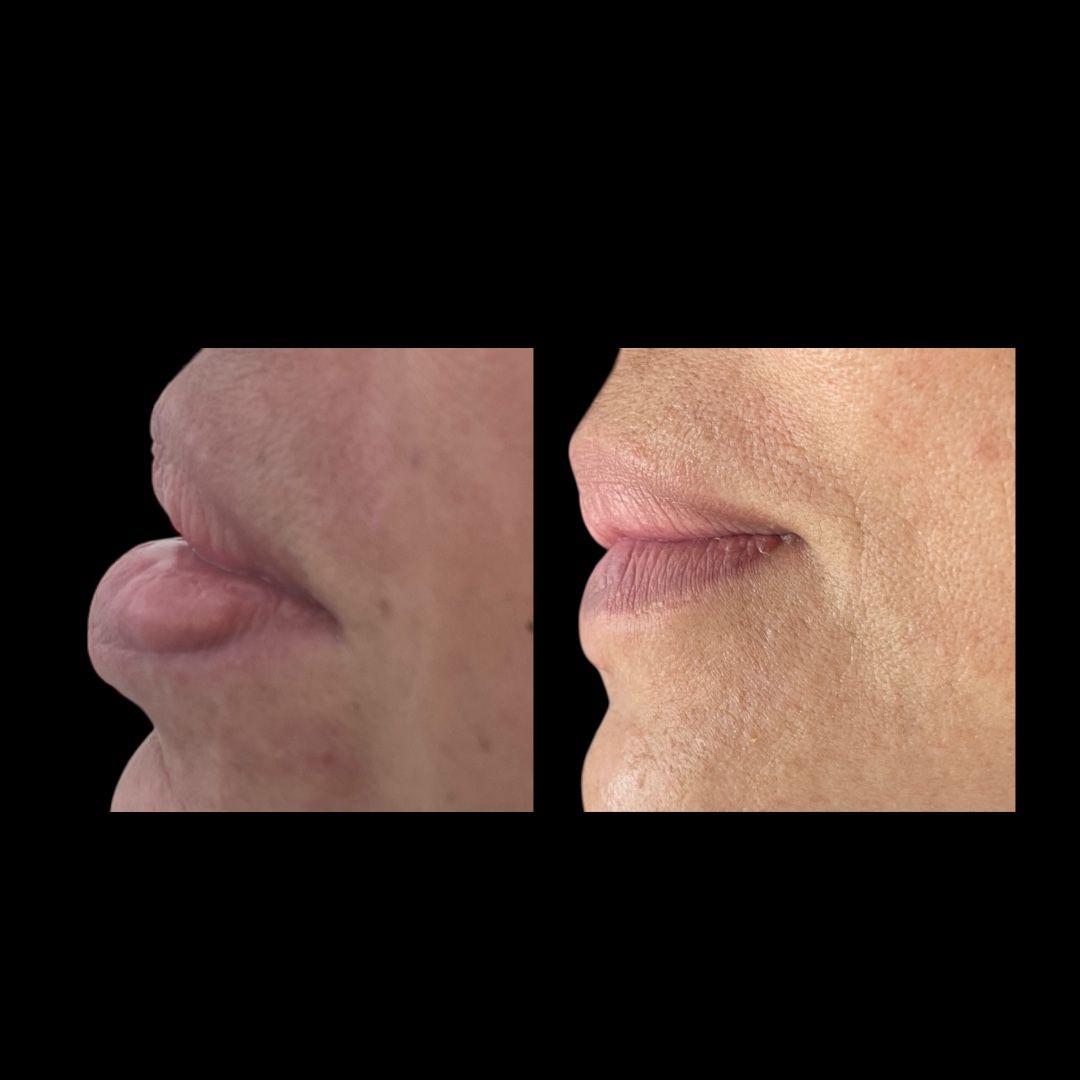 Jose Vicente Rocha Fernandez-53