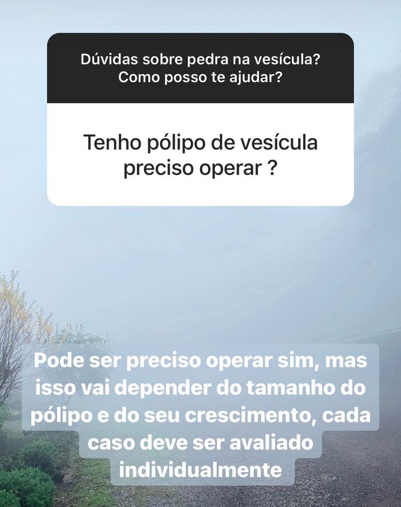 Nelson Bisneto-14
