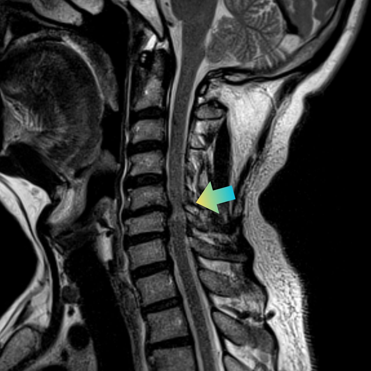 David Tafur Muñoz-2429