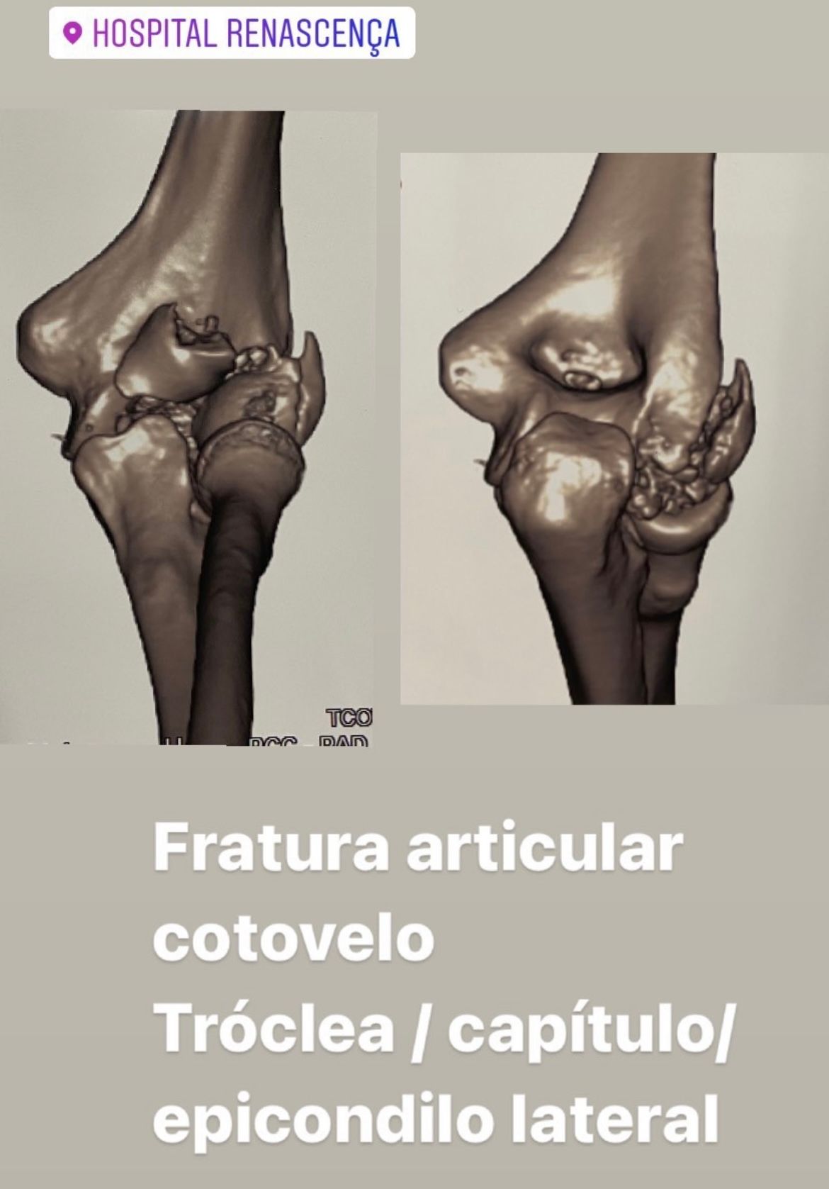 Fernando Gouvea-12